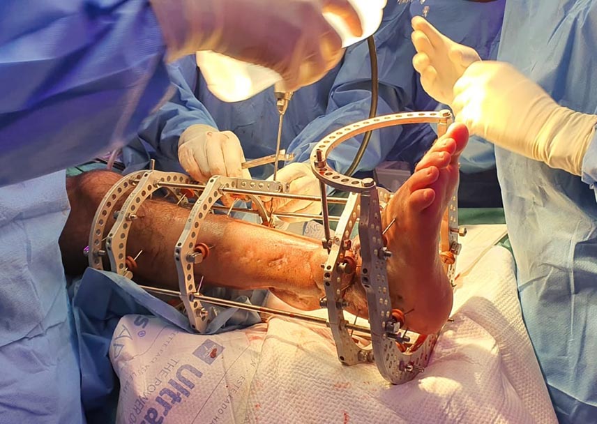 GOE Osteointegracion España