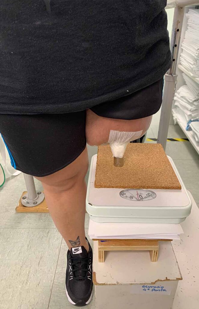 GOE Osteointegracion - Proceso de rehabilitación