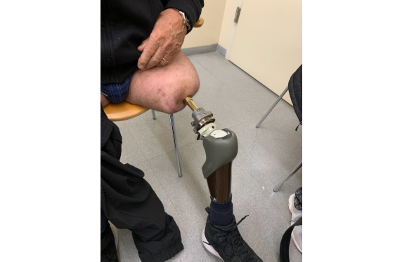 GOE Osteointegracion - Casos de éxito